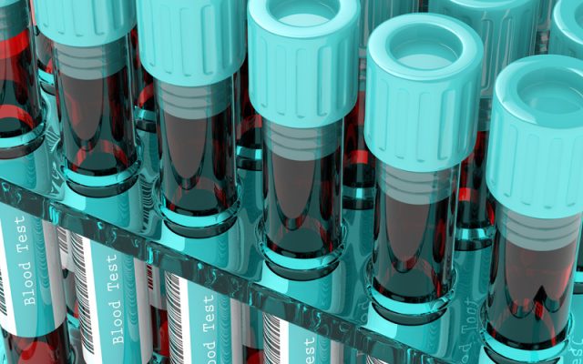 blood-test-800